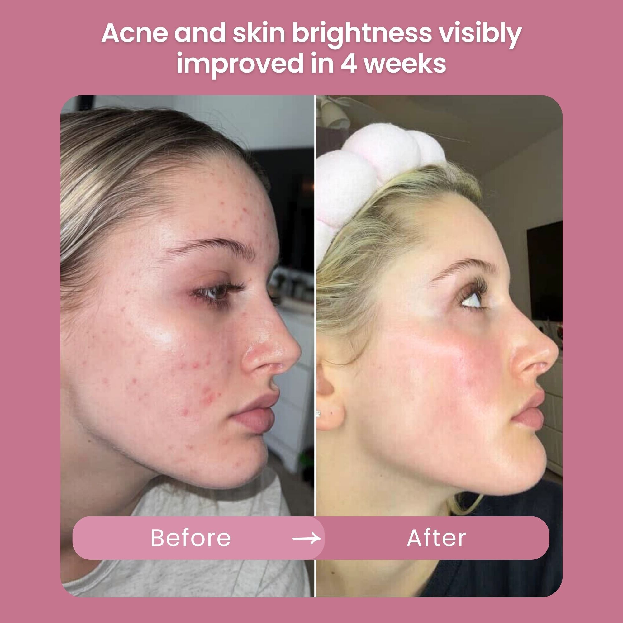 Suero iluminador de Kay