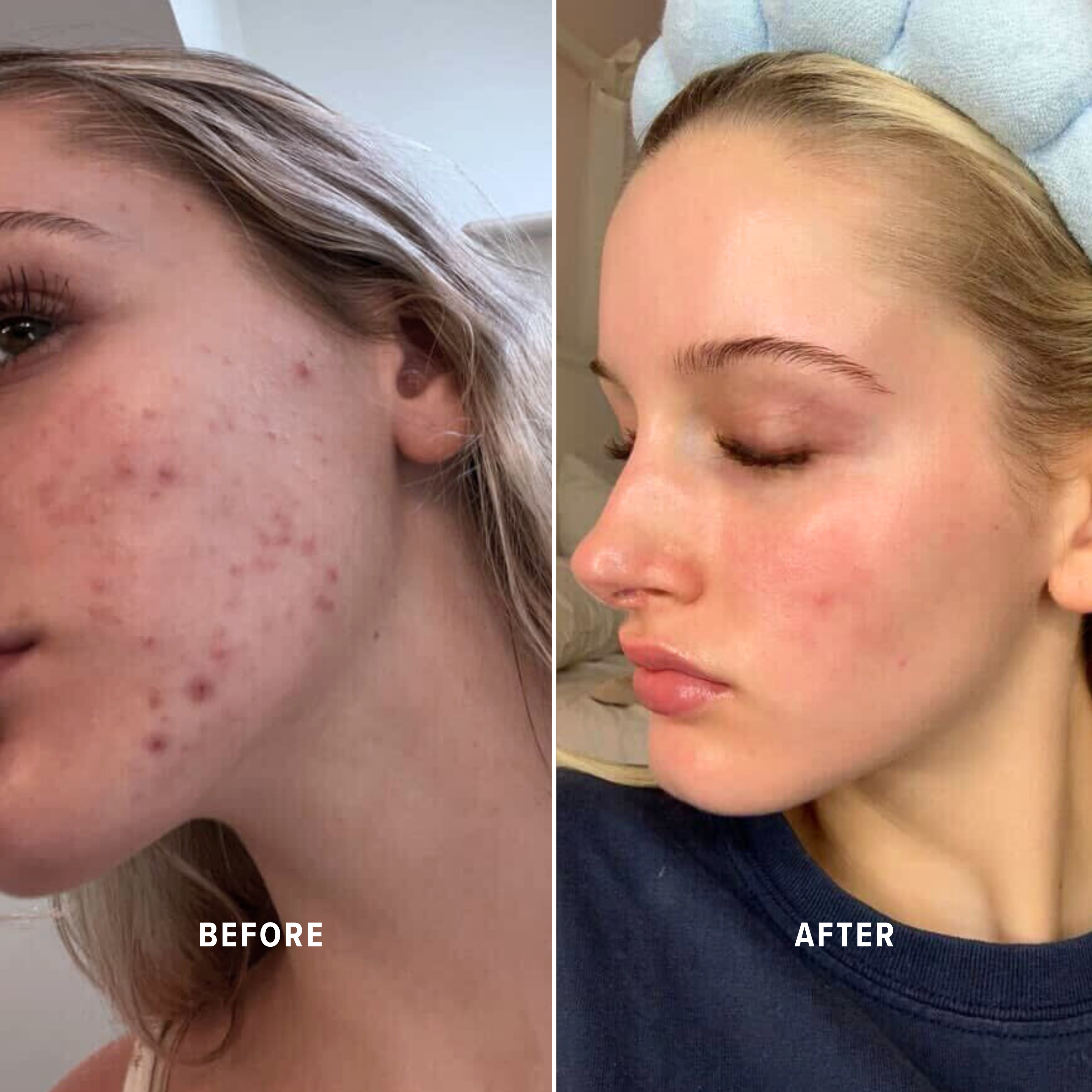 Humectante Infinite Aura