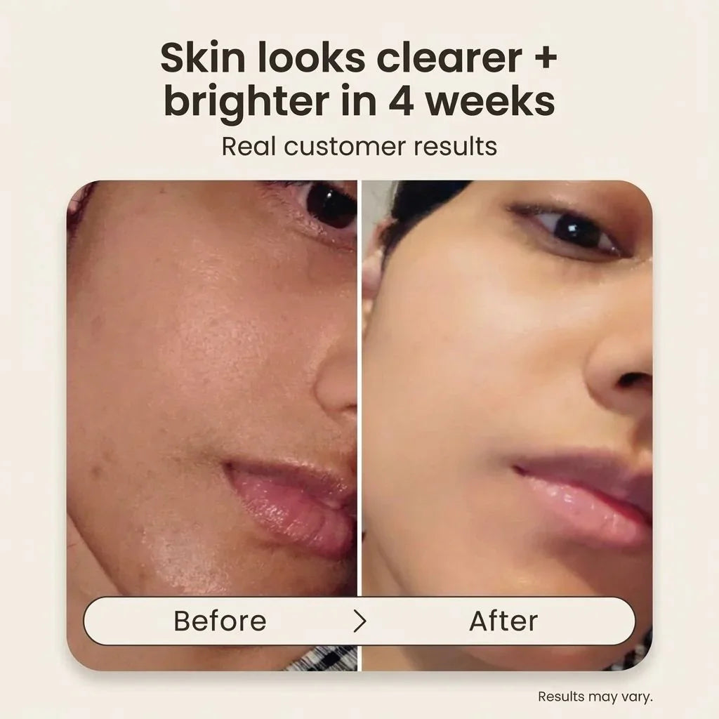 Bohemia Skin before and after results showing clearer, brighter skin in 4 weeks