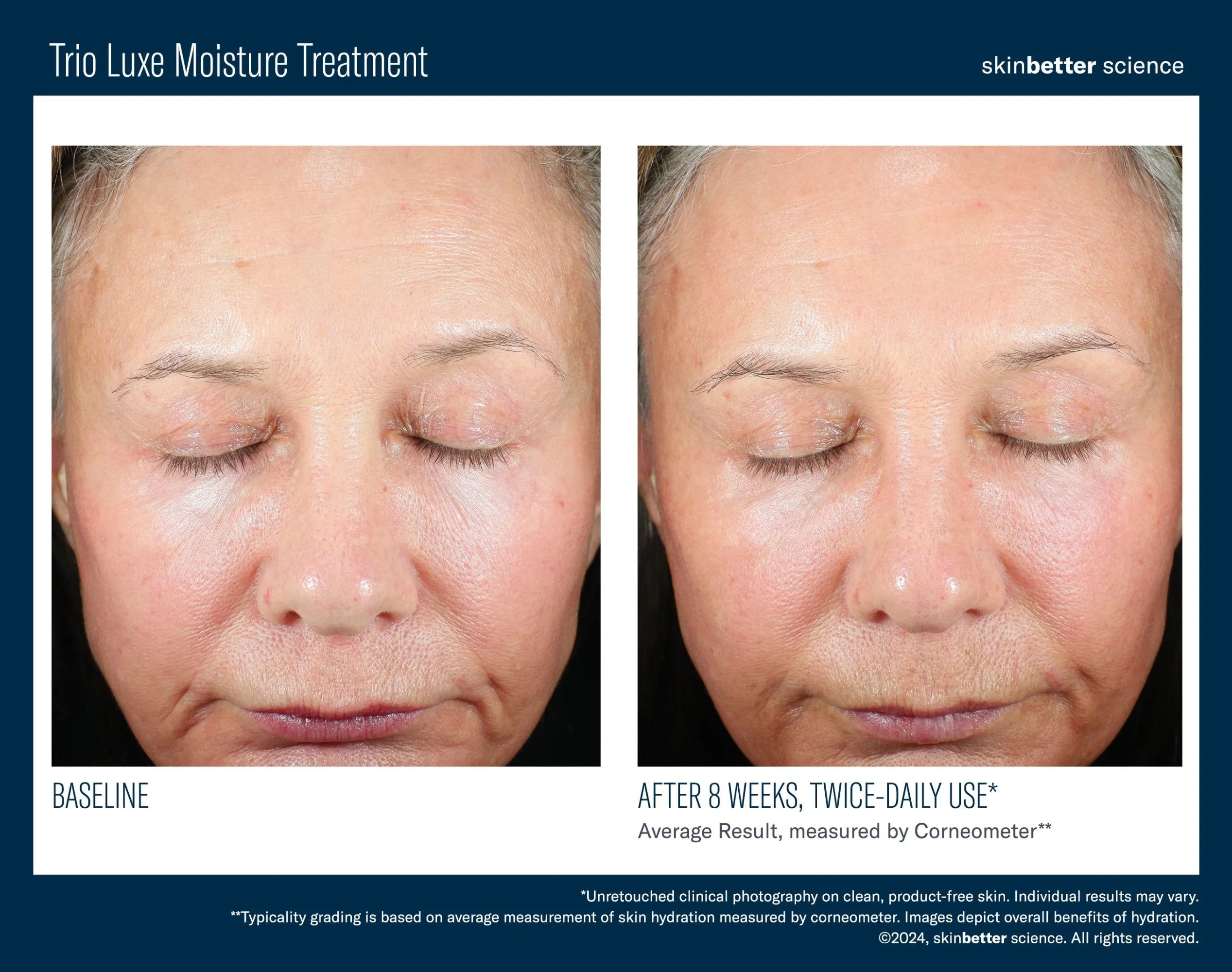 Before and after close-up of woman's face showing improved skin texture with Trio Luxe Moisture Treatment, Bohemia Skin focus.
