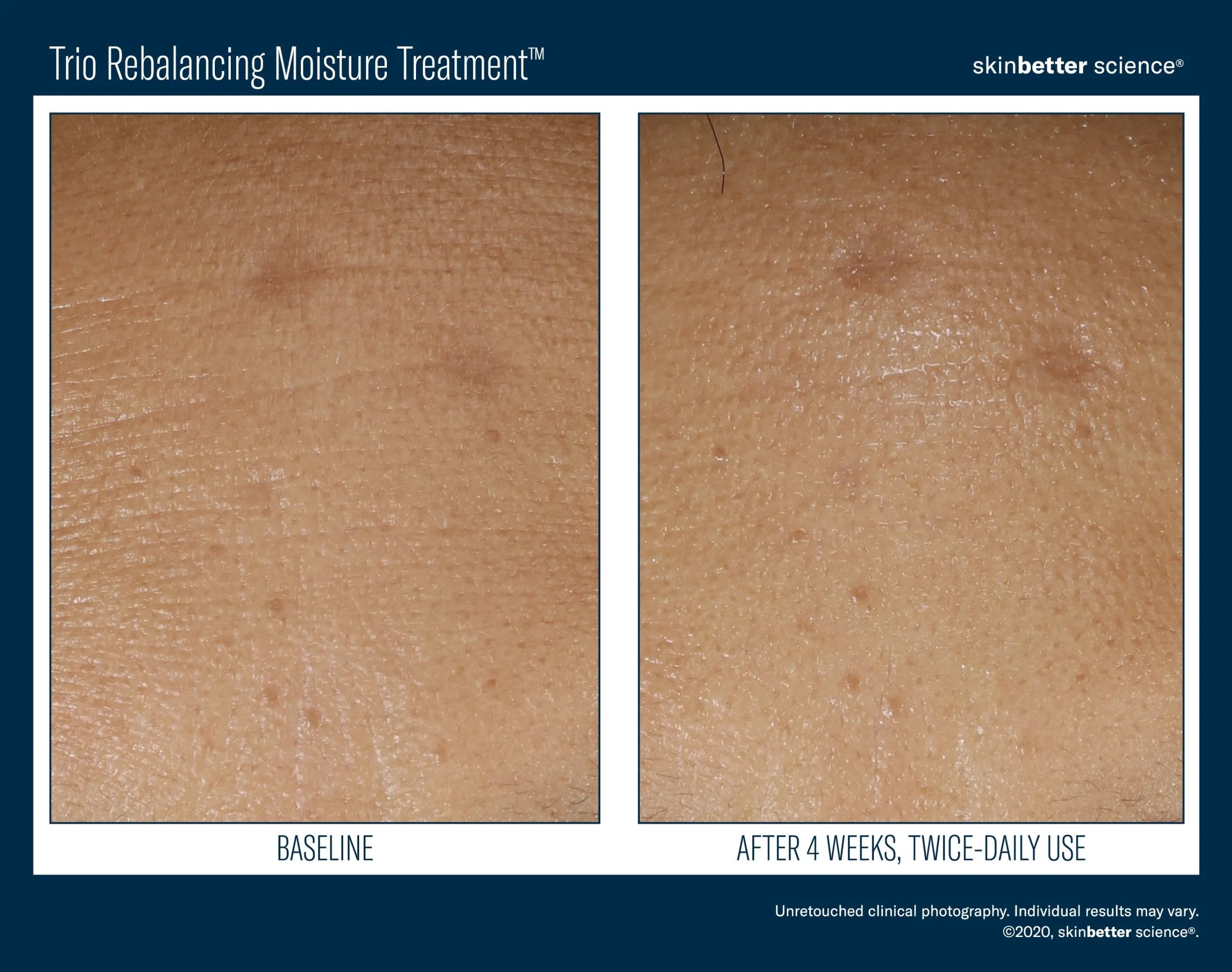 Trio Rebalancing Moisture Treatment before and after skin closeup, improved hydration results