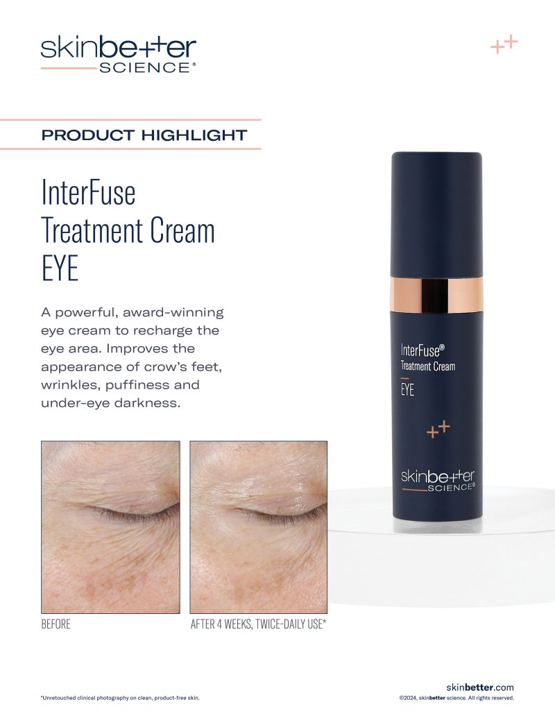 InterFuse Treatment Cream EYE