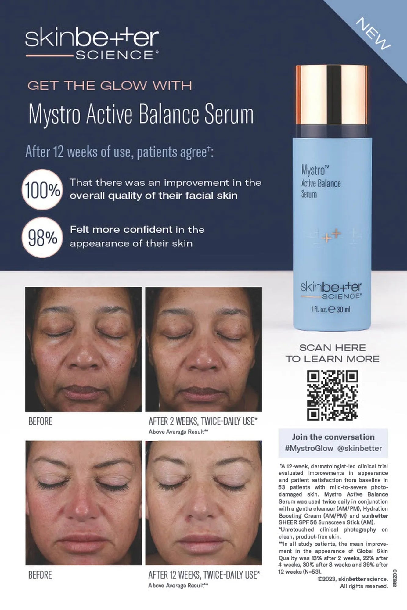 Skinbetter Science Mystro Active Balance Serum product image with before and after facial photos and statistics on improved skin quality, featured by Bohemia Skin.