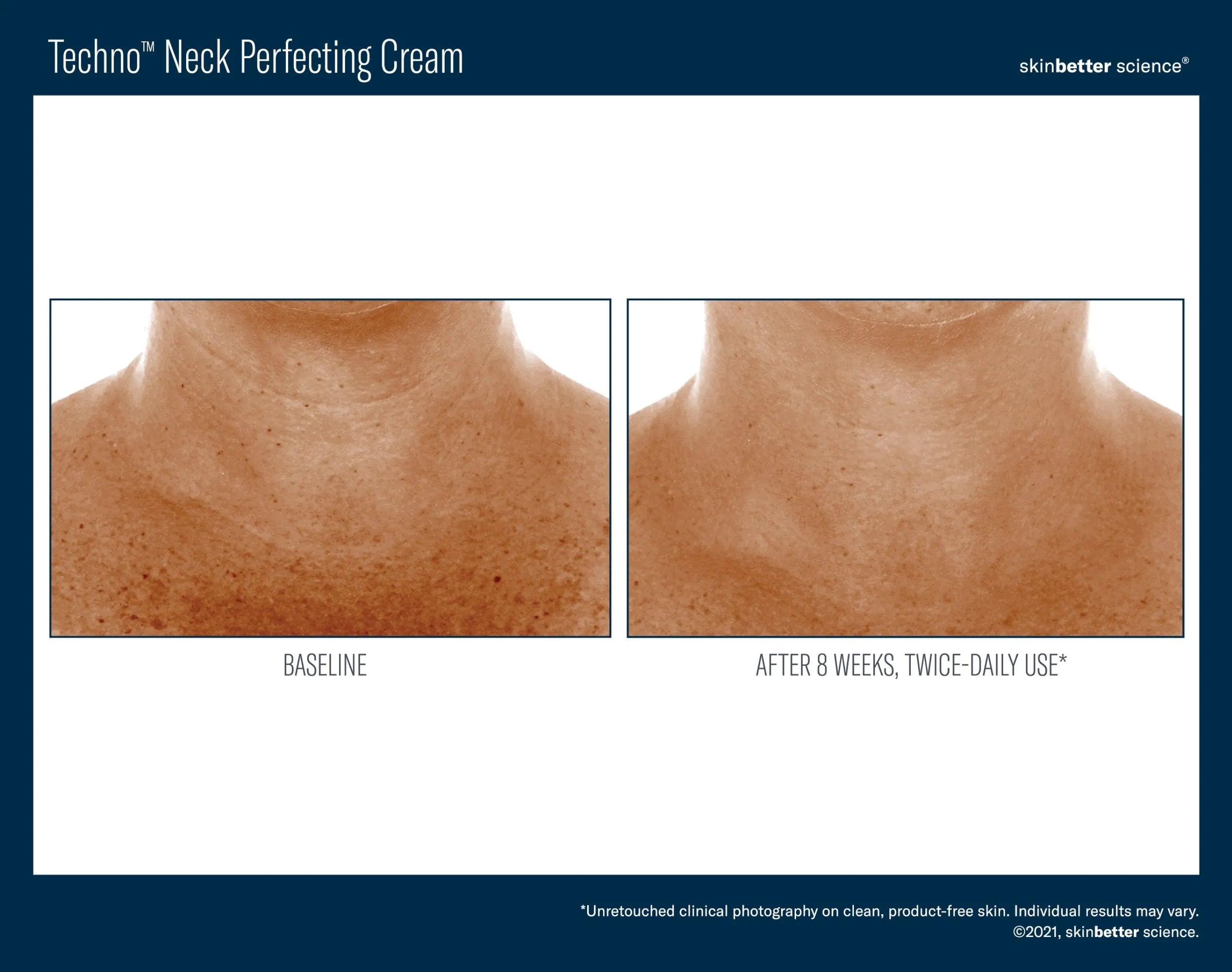 Before and after neck skincare results using Bohemia Skin cream, 8-week comparison.