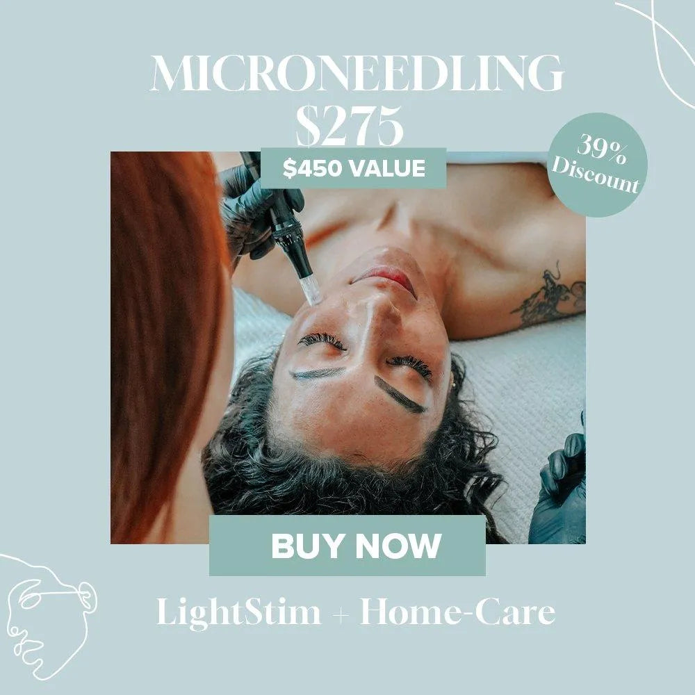 march-madness-microneedling-boho-skincare-526484 - Bohemia Skin